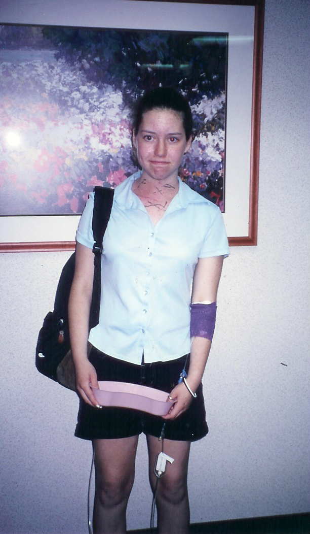 Jessica (14) with
chemo running,
May 2000.